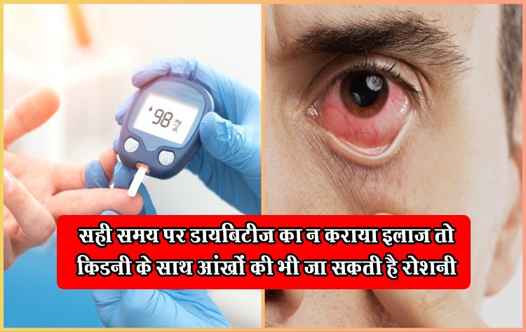 Health Tips : सही समय पर डायबिटीज का न कराया इलाज तो किडनी के साथ आंखों की भी जा सकती है रोशनी