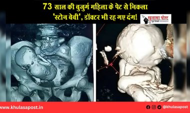 73 साल की बुज़ुर्ग महिला के पेट से निकला 'स्टोन बेबी', डॉक्टर भी रह गए दंग!