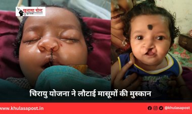 चिरायु योजना ने लौटाई मासूमों की मुस्कान