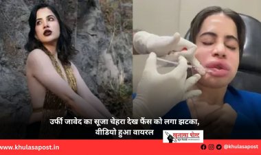 उर्फी जावेद का सूजा चेहरा देख फैंस को लगा झटका, वीडियो हुआ वायरल