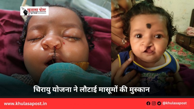 चिरायु योजना ने लौटाई मासूमों की मुस्कान