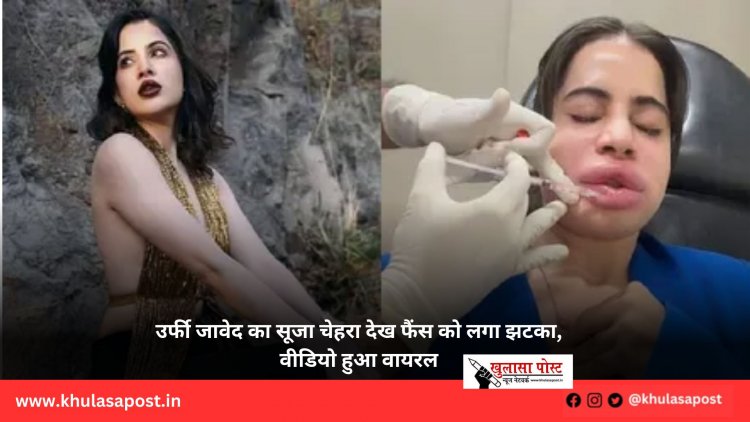 उर्फी जावेद का सूजा चेहरा देख फैंस को लगा झटका, वीडियो हुआ वायरल