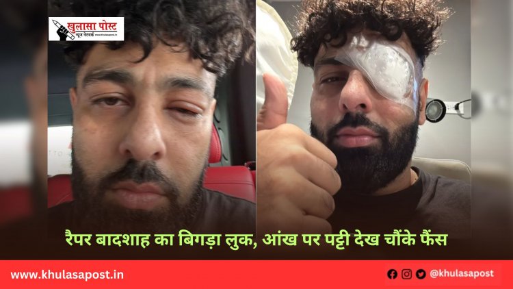 रैपर बादशाह का बिगड़ा लुक, आंख पर पट्टी देख चौंके फैंस